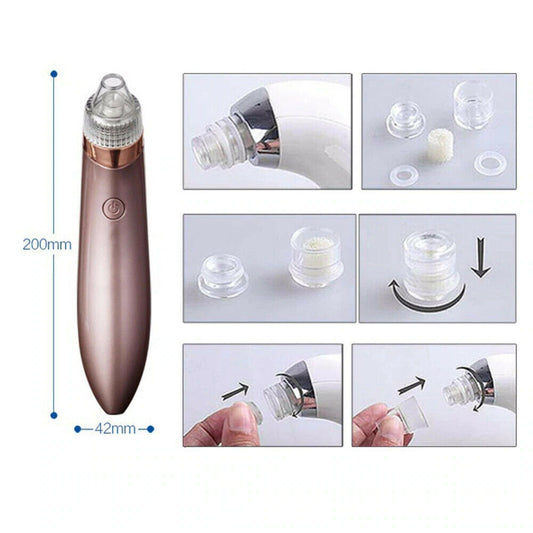 Aspirateur de Points Noirs Électrique