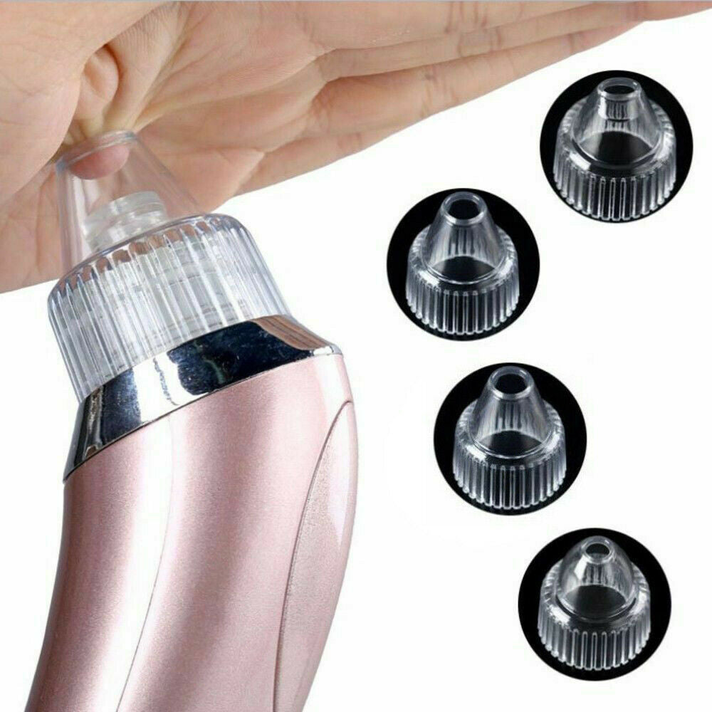Aspirateur de Points Noirs Électrique
